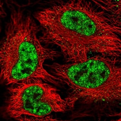 Invitrogen SF3B1 Polyclonal Antibody 100 &mu;L; Unconjugated:Antibodies,