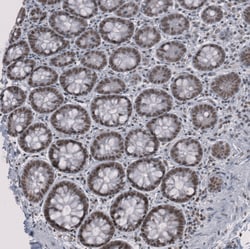Invitrogen SF3B1 Polyclonal Antibody 100 &mu;L; Unconjugated:Antibodies,