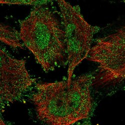 Invitrogen SIN3B Polyclonal Antibody 100 &mu;L; Unconjugated:Antibodies,