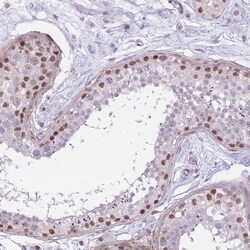 Invitrogen SIN3B Polyclonal Antibody 100 &mu;L; Unconjugated:Antibodies,
