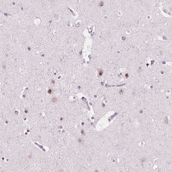 Invitrogen NOLC1 Polyclonal Antibody 100 &mu;L | Buy Online | Invitrogen&trade; | Fisher Scientific