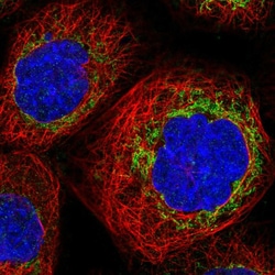 Invitrogen TBRG4 Polyclonal Antibody 100 &mu;L; Unconjugated:Antibodies,