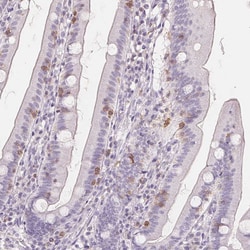 Invitrogen CD69 Polyclonal Antibody 100 &mu;L; Unconjugated:Antibodies,