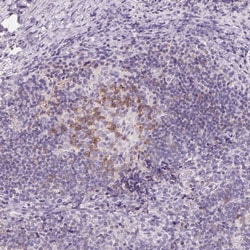 Invitrogen CD69 Polyclonal Antibody 100 &mu;L; Unconjugated:Antibodies,