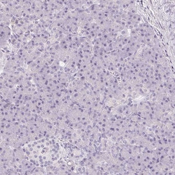 Invitrogen CD69 Polyclonal Antibody 100 &mu;L; Unconjugated:Antibodies,