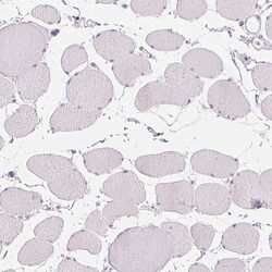 Invitrogen CD69 Polyclonal Antibody 100 &mu;L; Unconjugated:Antibodies,