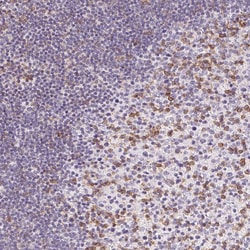 Invitrogen CD69 Polyclonal Antibody 100 &mu;L; Unconjugated:Antibodies,