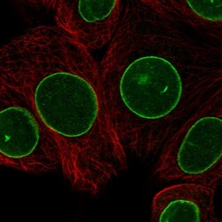 Invitrogen LAP1 Polyclonal Antibody 100 &mu;L; Unconjugated:Antibodies,