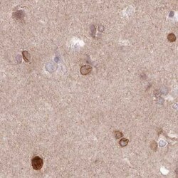 Invitrogen LAP1 Polyclonal Antibody 100 &mu;L; Unconjugated:Antibodies,