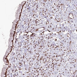 Invitrogen LAP1 Polyclonal Antibody 100 &mu;L; Unconjugated:Antibodies,