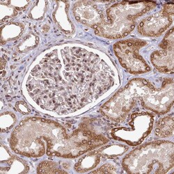 Invitrogen LAP1 Polyclonal Antibody 100 &mu;L; Unconjugated:Antibodies,