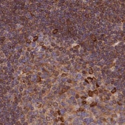 Invitrogen LAP1 Polyclonal Antibody 100 &mu;L; Unconjugated:Antibodies,