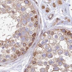 Invitrogen LAP1 Polyclonal Antibody 100 &mu;L; Unconjugated:Antibodies,