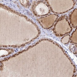 Invitrogen LAP1 Polyclonal Antibody 100 &mu;L; Unconjugated:Antibodies,