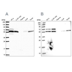 Invitrogen LAP1 Polyclonal Antibody 100 &mu;L | Buy Online | Invitrogen&trade; | Fisher Scientific