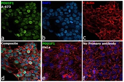Invitrogen PIT1 Polyclonal Antibody 100 &mu;L; Unconjugated:Antibodies,