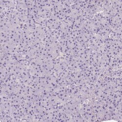 Invitrogen PIT1 Polyclonal Antibody 100 &mu;L; Unconjugated:Antibodies,