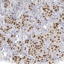 Invitrogen PIT1 Polyclonal Antibody 100 &mu;L; Unconjugated:Antibodies,