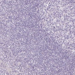 Invitrogen PIT1 Polyclonal Antibody 100 &mu;L; Unconjugated:Antibodies,