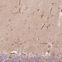 Invitrogen Fascin Polyclonal Antibody 100 &mu;L; Unconjugated:Antibodies,