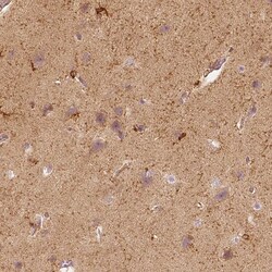 Invitrogen Fascin Polyclonal Antibody 100 &mu;L; Unconjugated:Antibodies,