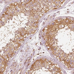 Invitrogen Fascin Polyclonal Antibody 100 &mu;L; Unconjugated:Antibodies,