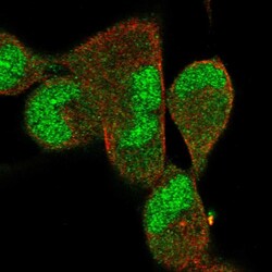 Invitrogen DNAJB5 Polyclonal Antibody 100 &mu;L; Unconjugated:Antibodies,
