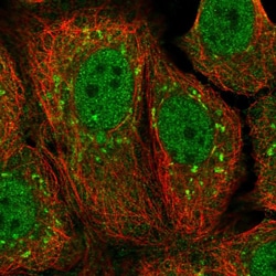 Invitrogen KCTD15 Polyclonal Antibody 100 &mu;L; Unconjugated:Antibodies,