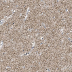 Invitrogen SLC25A23 Polyclonal Antibody 100 &mu;L; Unconjugated:Antibodies,