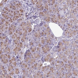 Invitrogen Clathrin Light Chain A Polyclonal Antibody 100 &mu;L; Unconjugated:Antibodies,