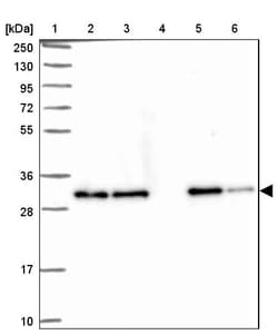 Invitrogen Clathrin Light Chain A Polyclonal Antibody 100 &mu;L; Unconjugated:Antibodies,