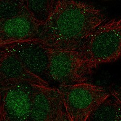Invitrogen TPI1 Polyclonal Antibody 100 &mu;L; Unconjugated:Antibodies,