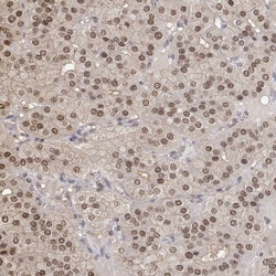Invitrogen TPI1 Polyclonal Antibody 100 &mu;L; Unconjugated:Antibodies,