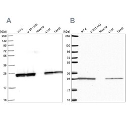 Invitrogen TPI1 Polyclonal Antibody 100 &mu;L; Unconjugated:Antibodies,
