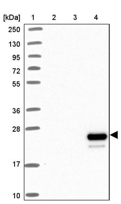 Invitrogen Apolipoprotein M Polyclonal Antibody 100 &mu;L; Unconjugated:Antistoffer