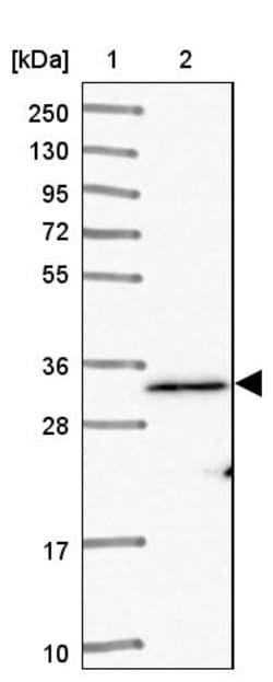 Invitrogen ADCK1 Polyclonal Antibody 100 &mu;L | Buy Online | Invitrogen&trade; | Fisher Scientific