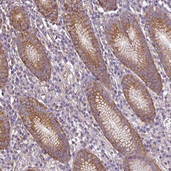 Invitrogen RP11-849H4.2 Polyclonal Antibody 100 &mu;L; Unconjugated:Antibodies,