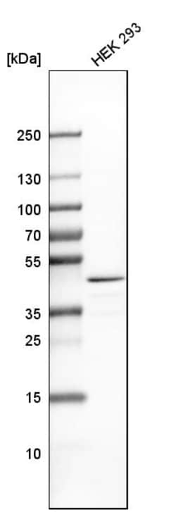 Invitrogen TRBP Polyclonal Antibody 100 &mu;L; Unconjugated:Antibodies,