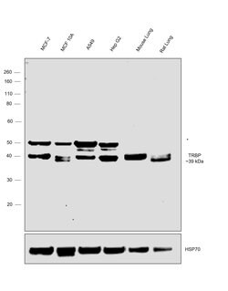 Invitrogen TRBP Polyclonal Antibody 100 &mu;L; Unconjugated:Antibodies,