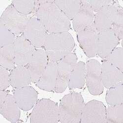 Invitrogen Calponin 3 Polyclonal Antibody 100 &mu;L; Unconjugated:Antibodies,