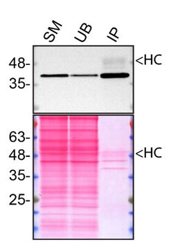 Invitrogen Calponin 3 Polyclonal Antibody 100 &mu;L; Unconjugated:Antibodies,