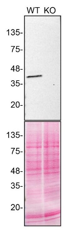 Invitrogen Calponin 3 Polyclonal Antibody 100 &mu;L; Unconjugated:Antibodies,
