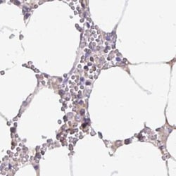 Invitrogen Catalase Polyclonal Antibody 100 &mu;L; Unconjugated:Antibodies,