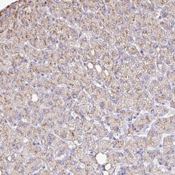 Invitrogen Catalase Polyclonal Antibody 100 &mu;L; Unconjugated:Antibodies,
