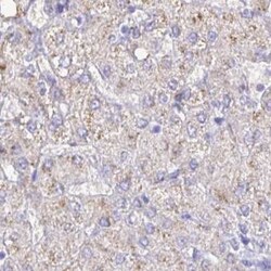 Invitrogen Catalase Polyclonal Antibody 100 &mu;L; Unconjugated:Antibodies,