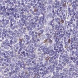 Invitrogen Catalase Polyclonal Antibody 100 &mu;L; Unconjugated:Antibodies,