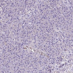 Invitrogen Catalase Polyclonal Antibody 100 &mu;L; Unconjugated:Antibodies,