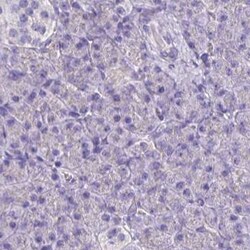 Invitrogen Catalase Polyclonal Antibody 100 &mu;L; Unconjugated:Antibodies,