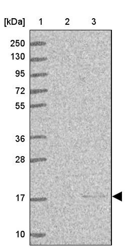 Invitrogen ENSA Polyclonal Antibody 100 &mu;L | Buy Online | Invitrogen&trade; | Fisher Scientific