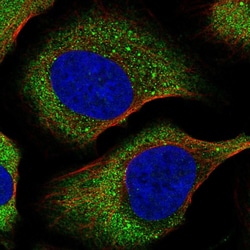 Invitrogen eIF4E Polyclonal Antibody 100 &mu;L; Unconjugated:Antibodies,